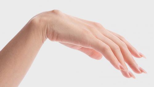 Появилась шишка на пальце руки и болит. Признаки гигромы тыла запястья 04 Появилась шишка на пальце руки и болит. Признаки гигромы тыла запястья 04