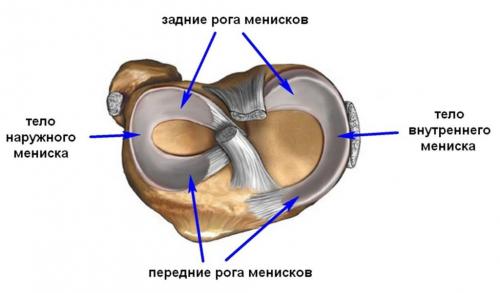 Разрыв заднего рога медиального мениска 3 степени нужна ли операция. Строение менисков и их функции