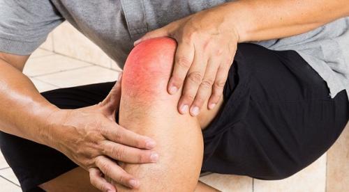 Горячая коленка и болит. Какие причины горячих коленей бывают? 03 Горячая коленка и болит. Какие причины горячих коленей бывают? 03