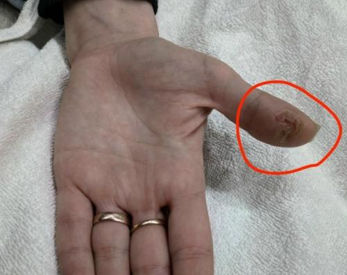 Когда хобби превращается в проблему: что может вызвать трещины на коже у начинающего мастера маникюра. 

