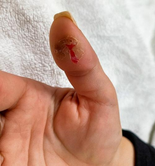 Когда хобби превращается в проблему: что может вызвать трещины на коже у начинающего мастера маникюра. 01