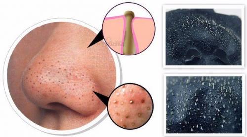 Домашний аналог знаменитой Black Mask. Домашний аналог знаменитой Black Mask.