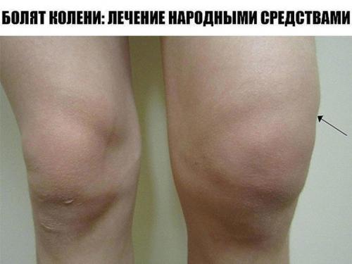 Лечение народными средствами. Лечение народными средствами.