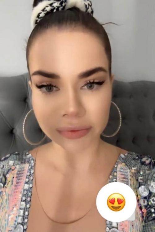 В сети активно обсуждают внешность Бьянки: заметная разница между ее образами в сторис и реальной жизнью без фильтров вызвала множество вопросов. 01