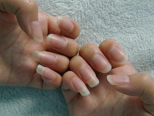 Проблемы с ногтями: что делать. Проблемы с ногтями: что делать.