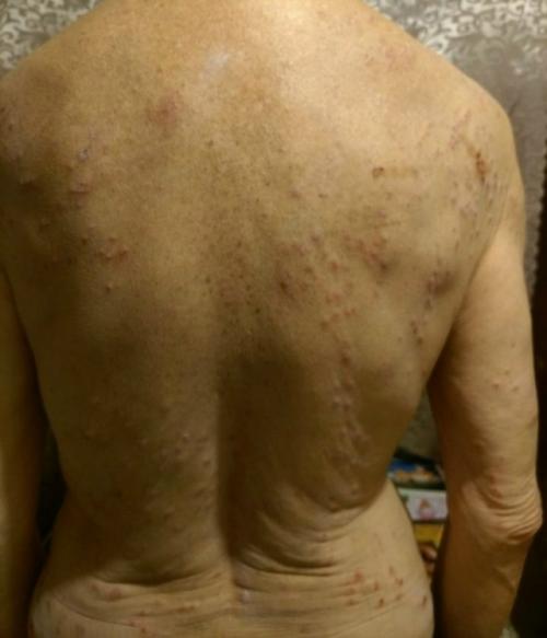 Мы к дерматологу обращались.  