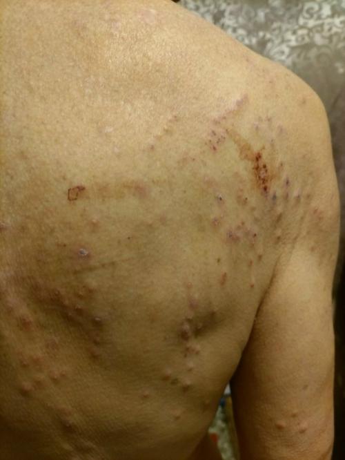 Мы к дерматологу обращались. 01