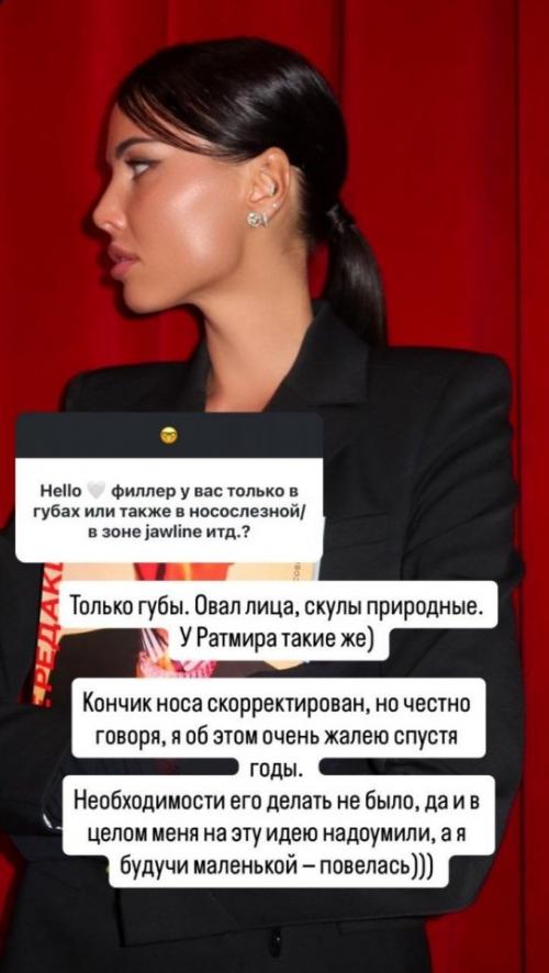 ЭТО Была НЕ МОЯ Идея Анастасия Решетова рассказала о своих пластических операциях, а также намекнула, что на неё их надоумили. 01