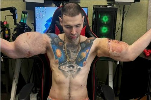 Бодибилдер Кирилл руки - базуки оказался на грани ампутации. 01