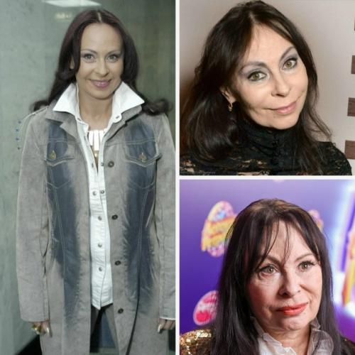 Лицо под угрозой деформации: врачи огорошили Марину Хлебникову пугающим диагнозом. 

