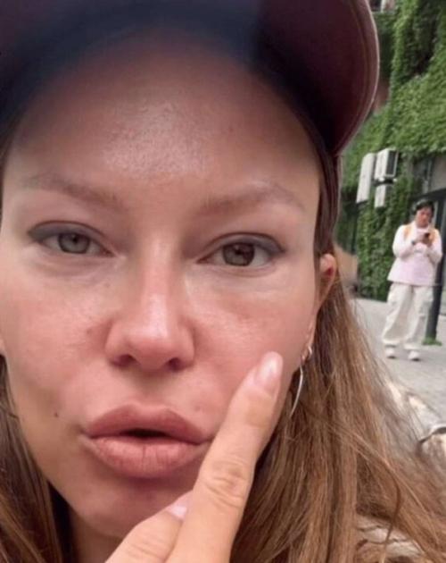 В прошлом году Рита дакота решилась лечь под нож пластического хирурга и сделала блефаропластику, но операция прошла неудачно.  