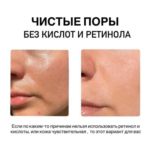 Хочу чистые поры, но боюсь использовать кислоты и ретинол. 
