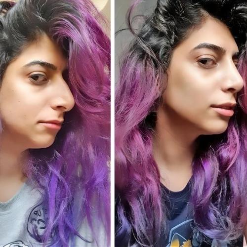 Иногда смотришь на человека после пластики и ловишь себя на мысли: 01