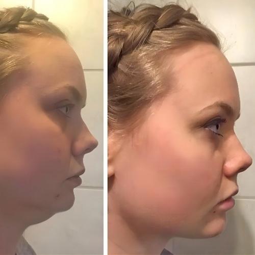 Иногда смотришь на человека после пластики и ловишь себя на мысли: 02