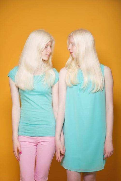 Альбиносы нереальной внешность обладают. 05