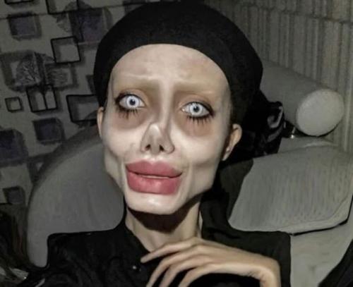 Девушка которая сделала более 50 операций чтоб стать похожей на Анджелину Джоли. 03