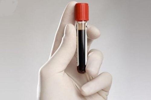 Группа крови может рассказать о тебе больше, чем ты думал. 
