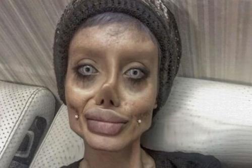 Девушка которая сделала более 50 операций чтоб стать похожей на Анджелину Джоли. 01