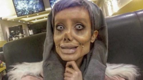 Девушка которая сделала более 50 операций чтоб стать похожей на Анджелину Джоли. 04