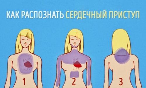 Как распознать сердечный приступ за месяц до того, как он случится. Как распознать сердечный приступ за месяц до того, как он случится.