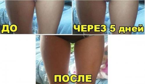 Горчично - медовое обертывание.

