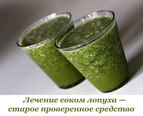 Лечение соком лопуха - старое проверенное средство. Лечение соком лопуха - старое проверенное средство.