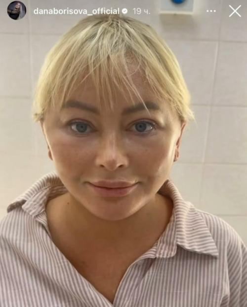 49-Летняя дана Борисова показала результаты очередной пластической операции. 01