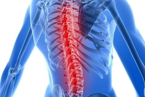 Меры профилактики и лечения - остеохондроз позвоночника.