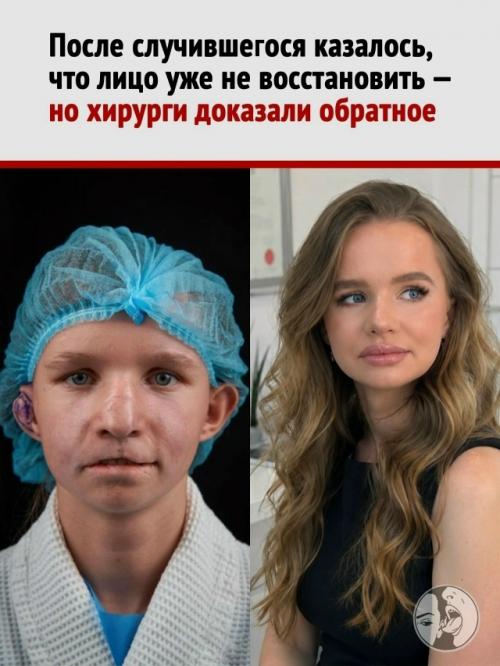 Хирурги сделали то, на что взрослые вокруг Дианы годами не решались: вмешались. Хирурги сделали то, на что взрослые вокруг Дианы годами не решались: вмешались.