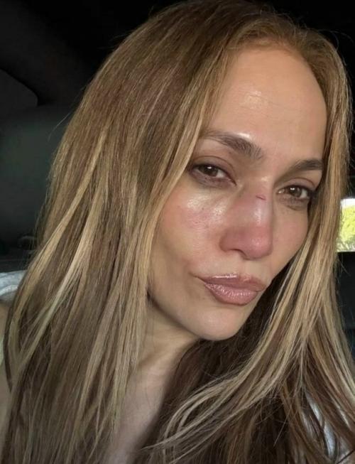 Дженнифер Лопес, которой 56 лет, получила серьезное повреждение лица в процессе репетиций.  