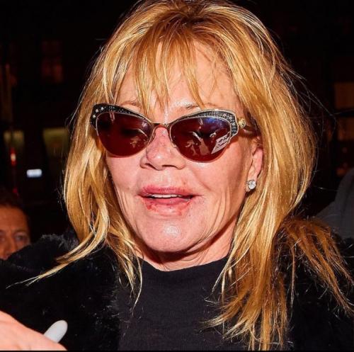 Жертвы пластических операций: Мелани гриффит. 02