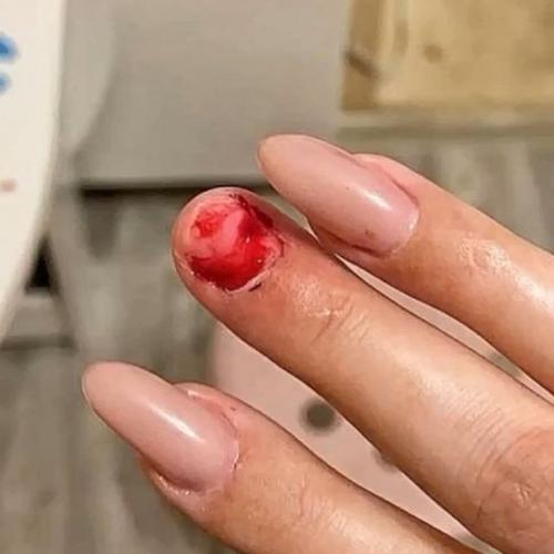 Только посмотрите, что произошло с моей подругой. 01