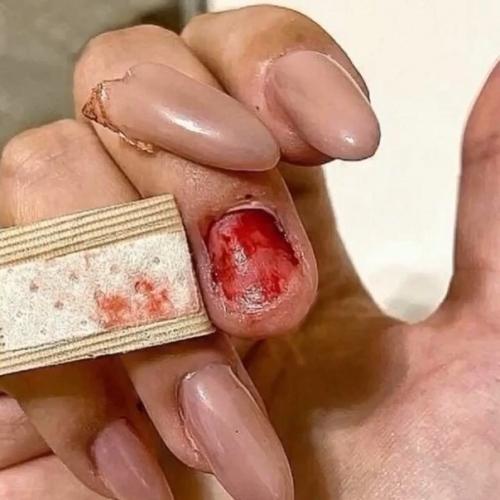 Только посмотрите, что произошло с моей подругой. 02