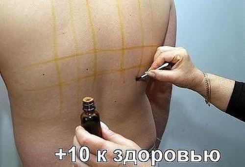 Целебные свойства йодовой сетки! Целебные свойства йодовой сетки!