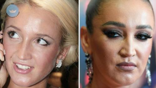 Ольга Бузова никогда не скрывала, что любит ухаживать за собой и регулярно прибегает к косметологическим процедурам.

