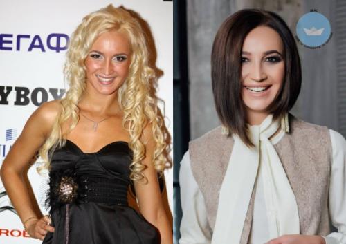 Ольга Бузова никогда не скрывала, что любит ухаживать за собой и регулярно прибегает к косметологическим процедурам. 01