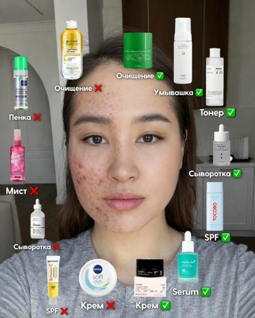 Акне, воспаления и забитые поры.
