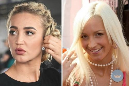 Ольга Бузова никогда не скрывала, что любит ухаживать за собой и регулярно прибегает к косметологическим процедурам. 03