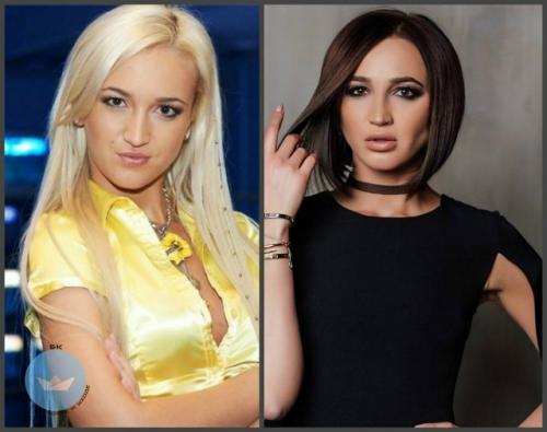 Ольга Бузова никогда не скрывала, что любит ухаживать за собой и регулярно прибегает к косметологическим процедурам. 02