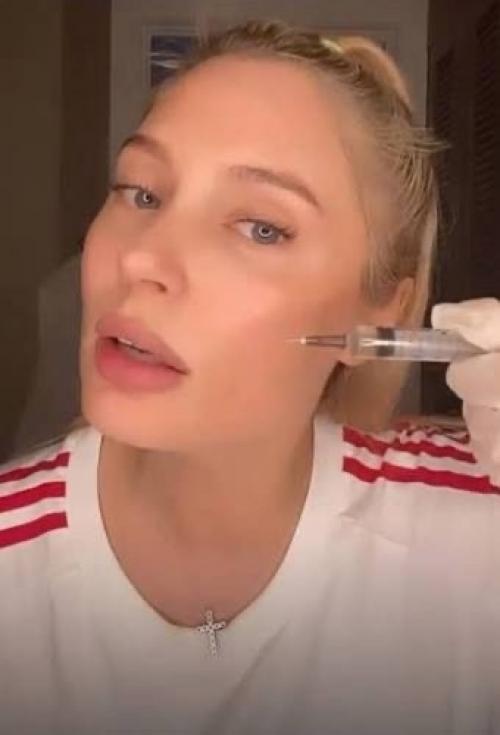 Обожаю Уколы: Наталья Рудова честно рассказала о своей любви к косметологии. 02