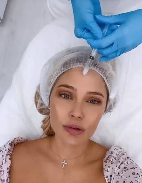 Обожаю Уколы: Наталья Рудова честно рассказала о своей любви к косметологии. 01