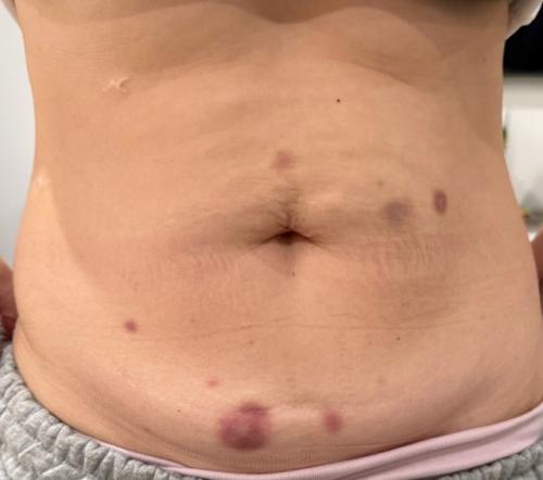 Ситуация странная: сидел, никого не трогал, а живот взял и посинел. 
