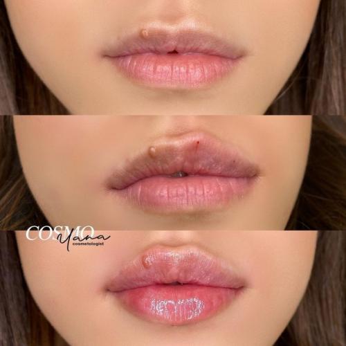 Лишь в том случае, если мастер хороший, то могут получиться красивые губки! 05