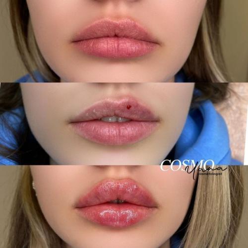 Лишь в том случае, если мастер хороший, то могут получиться красивые губки! 04