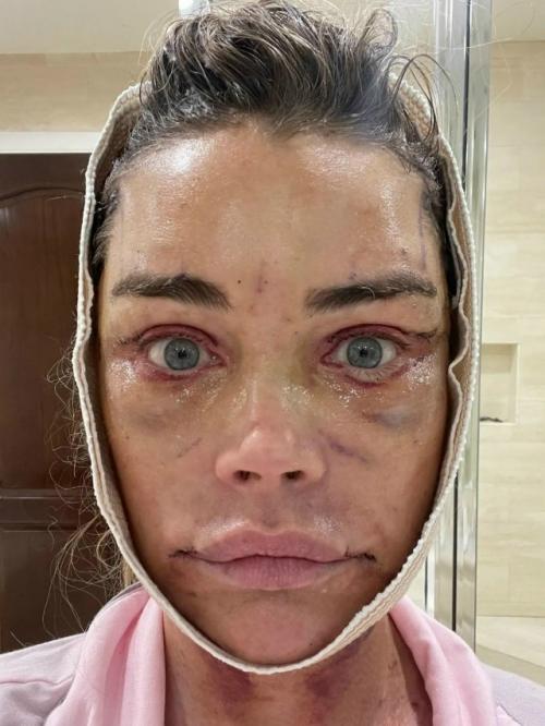 55-Летняя актриса Дениз Ричардс, секс - символ 90-х, смогла вернуть свою молодость и естественную красоту. 01