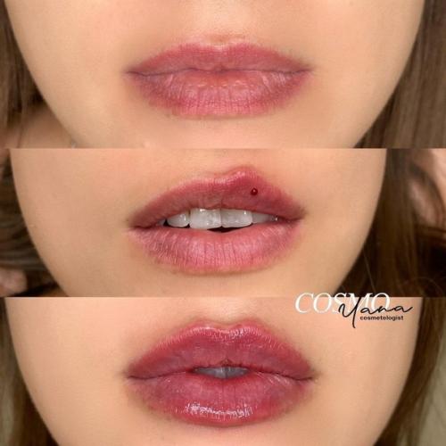 Лишь в том случае, если мастер хороший, то могут получиться красивые губки! 01