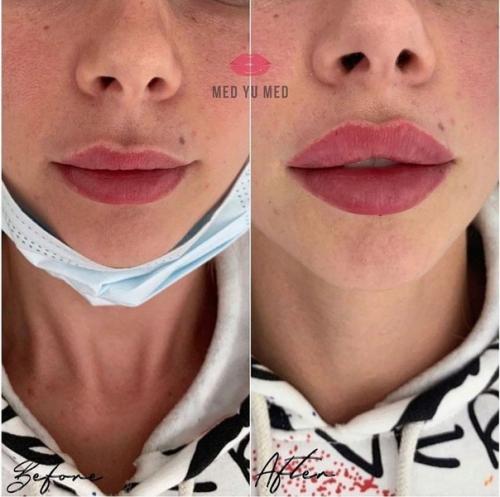 Лишь в том случае, если мастер хороший, то могут получиться красивые губки! 06