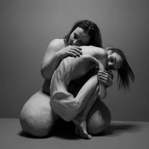 Сильные фото, которые были сделаны фо с целью обратить внимание на девушек страдающих РПП, анорексией и ожирением! 02