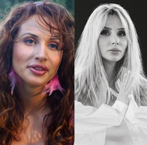 Российские знаменитости до и после пластики. 02