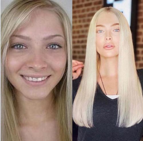 Российские знаменитости до и после пластики. 01